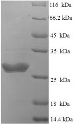 SDS-PAGE- Recombinant protein Bovine S