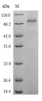 (Tris-Glycine gel) Discontinuous SDS-PAGE (reduced) with 5% enrichment gel and 15% separation gel. (Tris-Glycine gel) Discontinuous SDS-PAGE (reduced) with 5% enrichment gel and 15% separation gel.