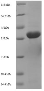 (Tris-Glycine gel) Discontinuous SDS-PAGE (reduced) with 5% enrichment gel and 15% separation gel.