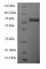 (Tris-Glycine gel) Discontinuous SDS-PAGE (reduced) with 5% enrichment gel and 15% separation gel.