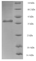 SDS-PAGE- Recombinant protein Saccharomyces GSP1