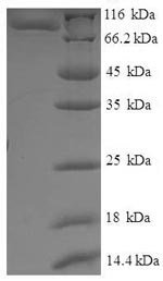 (Tris-Glycine gel) Discontinuous SDS-PAGE (reduced) with 5% enrichment gel and 15% separation gel. (Tris-Glycine gel) Discontinuous SDS-PAGE (reduced) with 5% enrichment gel and 15% separation gel.