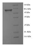 SDS-PAGE- Recombinant protein Peptoclostridium gluD