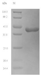 (Tris-Glycine gel) Discontinuous SDS-PAGE (reduced) with 5% enrichment gel and 15% separation gel. (Tris-Glycine gel) Discontinuous SDS-PAGE (reduced) with 5% enrichment gel and 15% separation gel.