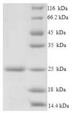 (Tris-Glycine gel) Discontinuous SDS-PAGE (reduced) with 5% enrichment gel and 15% separation gel. (Tris-Glycine gel) Discontinuous SDS-PAGE (reduced) with 5% enrichment gel and 15% separation gel.