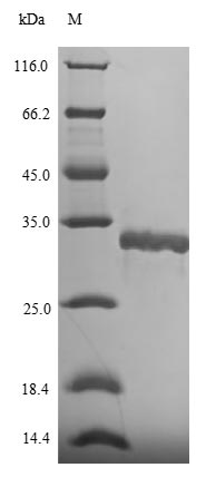 (Tris-Glycine gel) Discontinuous SDS-PAGE (reduced) with 5% enrichment gel and 15% separation gel. (Tris-Glycine gel) Discontinuous SDS-PAGE (reduced) with 5% enrichment gel and 15% separation gel.