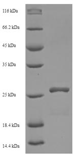 (Tris-Glycine gel) Discontinuous SDS-PAGE (reduced) with 5% enrichment gel and 15% separation gel. (Tris-Glycine gel) Discontinuous SDS-PAGE (reduced) with 5% enrichment gel and 15% separation gel.