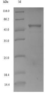 (Tris-Glycine gel) Discontinuous SDS-PAGE (reduced) with 5% enrichment gel and 15% separation gel. (Tris-Glycine gel) Discontinuous SDS-PAGE (reduced) with 5% enrichment gel and 15% separation gel.