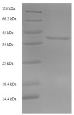 (Tris-Glycine gel) Discontinuous SDS-PAGE (reduced) with 5% enrichment gel and 15% separation gel.