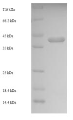 SDS-PAGE- Recombinant protein Staphylococcus entC2
