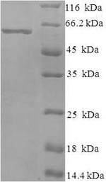(Tris-Glycine gel) Discontinuous SDS-PAGE (reduced) with 5% enrichment gel and 15% separation gel. (Tris-Glycine gel) Discontinuous SDS-PAGE (reduced) with 5% enrichment gel and 15% separation gel.