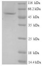 (Tris-Glycine gel) Discontinuous SDS-PAGE (reduced) with 5% enrichment gel and 15% separation gel. (Tris-Glycine gel) Discontinuous SDS-PAGE (reduced) with 5% enrichment gel and 15% separation gel.