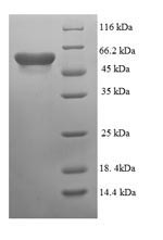 (Tris-Glycine gel) Discontinuous SDS-PAGE (reduced) with 5% enrichment gel and 15% separation gel.