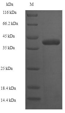 (Tris-Glycine gel) Discontinuous SDS-PAGE (reduced) with 5% enrichment gel and 15% separation gel. (Tris-Glycine gel) Discontinuous SDS-PAGE (reduced) with 5% enrichment gel and 15% separation gel.