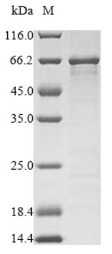 (Tris-Glycine gel) Discontinuous SDS-PAGE (reduced) with 5% enrichment gel and 15% separation gel. (Tris-Glycine gel) Discontinuous SDS-PAGE (reduced) with 5% enrichment gel and 15% separation gel.