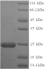 (Tris-Glycine gel) Discontinuous SDS-PAGE (reduced) with 5% enrichment gel and 15% separation gel. (Tris-Glycine gel) Discontinuous SDS-PAGE (reduced) with 5% enrichment gel and 15% separation gel.