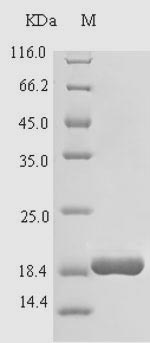 (Tris-Glycine gel) Discontinuous SDS-PAGE (reduced) with 5% enrichment gel and 15% separation gel. (Tris-Glycine gel) Discontinuous SDS-PAGE (reduced) with 5% enrichment gel and 15% separation gel.