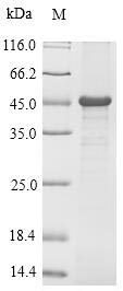 (Tris-Glycine gel) Discontinuous SDS-PAGE (reduced) with 5% enrichment gel and 15% separation gel. (Tris-Glycine gel) Discontinuous SDS-PAGE (reduced) with 5% enrichment gel and 15% separation gel.