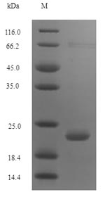 (Tris-Glycine gel) Discontinuous SDS-PAGE (reduced) with 5% enrichment gel and 15% separation gel. (Tris-Glycine gel) Discontinuous SDS-PAGE (reduced) with 5% enrichment gel and 15% separation gel.