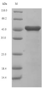 (Tris-Glycine gel) Discontinuous SDS-PAGE (reduced) with 5% enrichment gel and 15% separation gel.