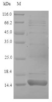 (Tris-Glycine gel) Discontinuous SDS-PAGE (reduced) with 5% enrichment gel and 15% separation gel. (Tris-Glycine gel) Discontinuous SDS-PAGE (reduced) with 5% enrichment gel and 15% separation gel.