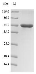 (Tris-Glycine gel) Discontinuous SDS-PAGE (reduced) with 5% enrichment gel and 15% separation gel. (Tris-Glycine gel) Discontinuous SDS-PAGE (reduced) with 5% enrichment gel and 15% separation gel.