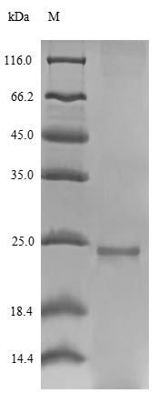 (Tris-Glycine gel) Discontinuous SDS-PAGE (reduced) with 5% enrichment gel and 15% separation gel. (Tris-Glycine gel) Discontinuous SDS-PAGE (reduced) with 5% enrichment gel and 15% separation gel.