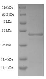(Tris-Glycine gel) Discontinuous SDS-PAGE (reduced) with 5% enrichment gel and 15% separation gel. (Tris-Glycine gel) Discontinuous SDS-PAGE (reduced) with 5% enrichment gel and 15% separation gel.