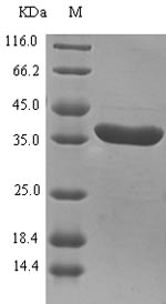 (Tris-Glycine gel) Discontinuous SDS-PAGE (reduced) with 5% enrichment gel and 15% separation gel.