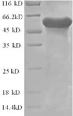 (Tris-Glycine gel) Discontinuous SDS-PAGE (reduced) with 5% enrichment gel and 15% separation gel. (Tris-Glycine gel) Discontinuous SDS-PAGE (reduced) with 5% enrichment gel and 15% separation gel.