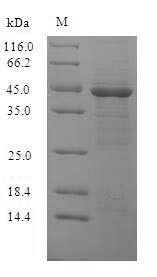 (Tris-Glycine gel) Discontinuous SDS-PAGE (reduced) with 5% enrichment gel and 15% separation gel. (Tris-Glycine gel) Discontinuous SDS-PAGE (reduced) with 5% enrichment gel and 15% separation gel.