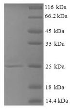 (Tris-Glycine gel) Discontinuous SDS-PAGE (reduced) with 5% enrichment gel and 15% separation gel. (Tris-Glycine gel) Discontinuous SDS-PAGE (reduced) with 5% enrichment gel and 15% separation gel.