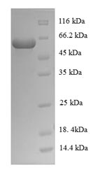 SDS-PAGE- Recombinant protein Mycobacterium cyp125
