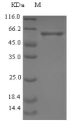 (Tris-Glycine gel) Discontinuous SDS-PAGE (reduced) with 5% enrichment gel and 15% separation gel. (Tris-Glycine gel) Discontinuous SDS-PAGE (reduced) with 5% enrichment gel and 15% separation gel.