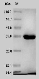 (Tris-Glycine gel) Discontinuous SDS-PAGE (reduced) with 5% enrichment gel and 15% separation gel.