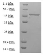 (Tris-Glycine gel) Discontinuous SDS-PAGE (reduced) with 5% enrichment gel and 15% separation gel. (Tris-Glycine gel) Discontinuous SDS-PAGE (reduced) with 5% enrichment gel and 15% separation gel.
