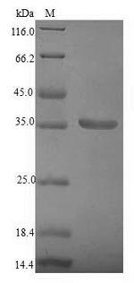 (Tris-Glycine gel) Discontinuous SDS-PAGE (reduced) with 5% enrichment gel and 15% separation gel.