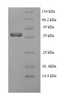 SDS-PAGE- Recombinant protein Epstein-Barr BZLF1