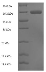 (Tris-Glycine gel) Discontinuous SDS-PAGE (reduced) with 5% enrichment gel and 15% separation gel. (Tris-Glycine gel) Discontinuous SDS-PAGE (reduced) with 5% enrichment gel and 15% separation gel.