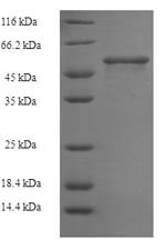 (Tris-Glycine gel) Discontinuous SDS-PAGE (reduced) with 5% enrichment gel and 15% separation gel. (Tris-Glycine gel) Discontinuous SDS-PAGE (reduced) with 5% enrichment gel and 15% separation gel.