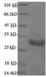 (Tris-Glycine gel) Discontinuous SDS-PAGE (reduced) with 5% enrichment gel and 15% separation gel.