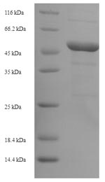 (Tris-Glycine gel) Discontinuous SDS-PAGE (reduced) with 5% enrichment gel and 15% separation gel. (Tris-Glycine gel) Discontinuous SDS-PAGE (reduced) with 5% enrichment gel and 15% separation gel.