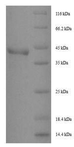 (Tris-Glycine gel) Discontinuous SDS-PAGE (reduced) with 5% enrichment gel and 15% separation gel. (Tris-Glycine gel) Discontinuous SDS-PAGE (reduced) with 5% enrichment gel and 15% separation gel.