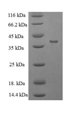 SDS-PAGE- Recombinant protein Escherichia ompT