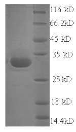 (Tris-Glycine gel) Discontinuous SDS-PAGE (reduced) with 5% enrichment gel and 15% separation gel. (Tris-Glycine gel) Discontinuous SDS-PAGE (reduced) with 5% enrichment gel and 15% separation gel.