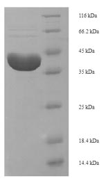 (Tris-Glycine gel) Discontinuous SDS-PAGE (reduced) with 5% enrichment gel and 15% separation gel.