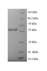 (Tris-Glycine gel) Discontinuous SDS-PAGE (reduced) with 5% enrichment gel and 15% separation gel. (Tris-Glycine gel) Discontinuous SDS-PAGE (reduced) with 5% enrichment gel and 15% separation gel.