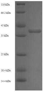 (Tris-Glycine gel) Discontinuous SDS-PAGE (reduced) with 5% enrichment gel and 15% separation gel. (Tris-Glycine gel) Discontinuous SDS-PAGE (reduced) with 5% enrichment gel and 15% separation gel.