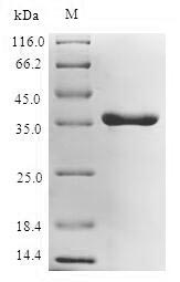 (Tris-Glycine gel) Discontinuous SDS-PAGE (reduced) with 5% enrichment gel and 15% separation gel. (Tris-Glycine gel) Discontinuous SDS-PAGE (reduced) with 5% enrichment gel and 15% separation gel.