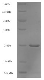 (Tris-Glycine gel) Discontinuous SDS-PAGE (reduced) with 5% enrichment gel and 15% separation gel. (Tris-Glycine gel) Discontinuous SDS-PAGE (reduced) with 5% enrichment gel and 15% separation gel.